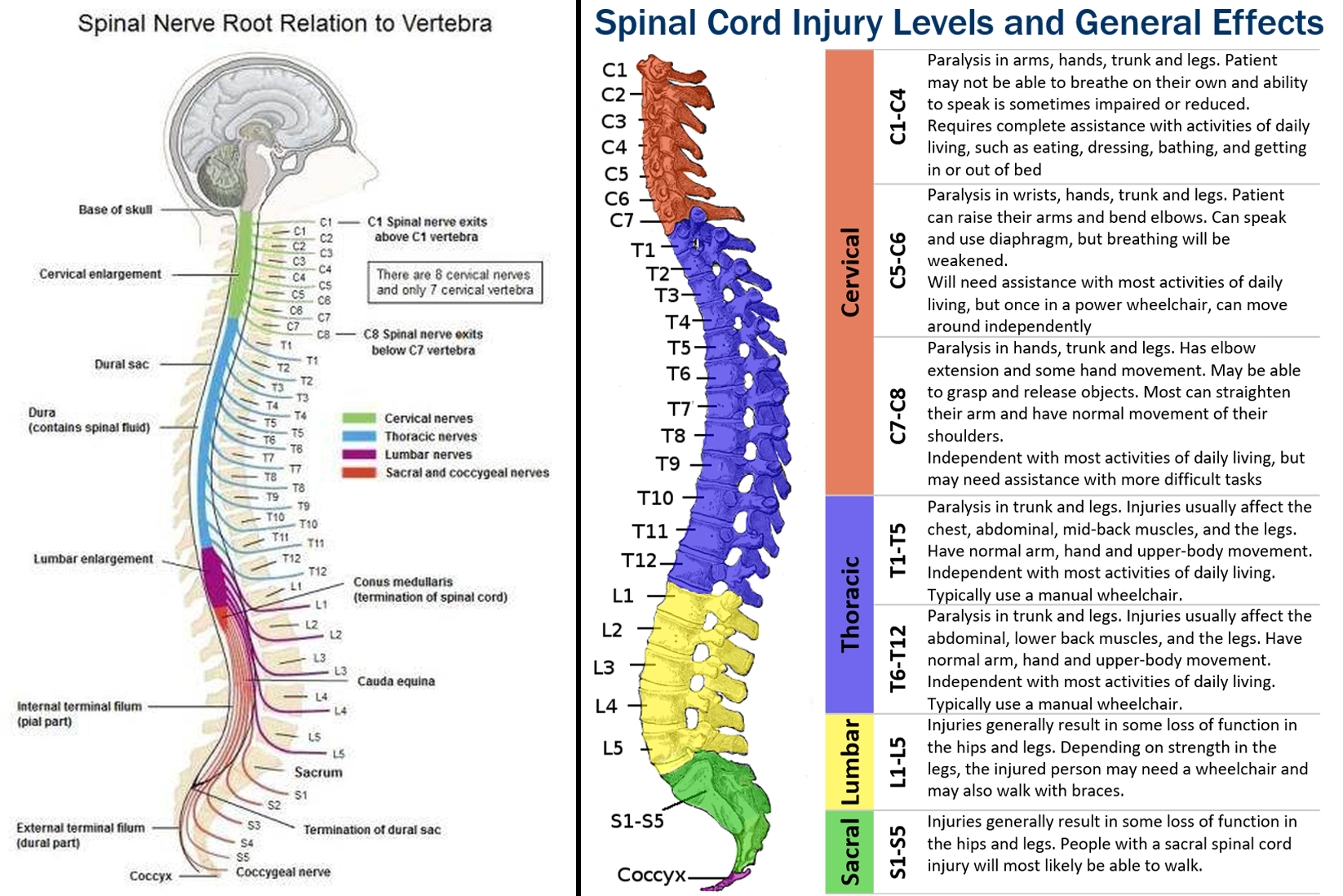 Understanding a Spinal Cord Injury